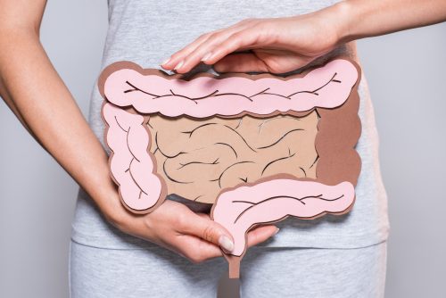 Colon cancer